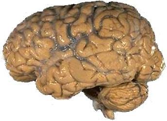 The Human Brain